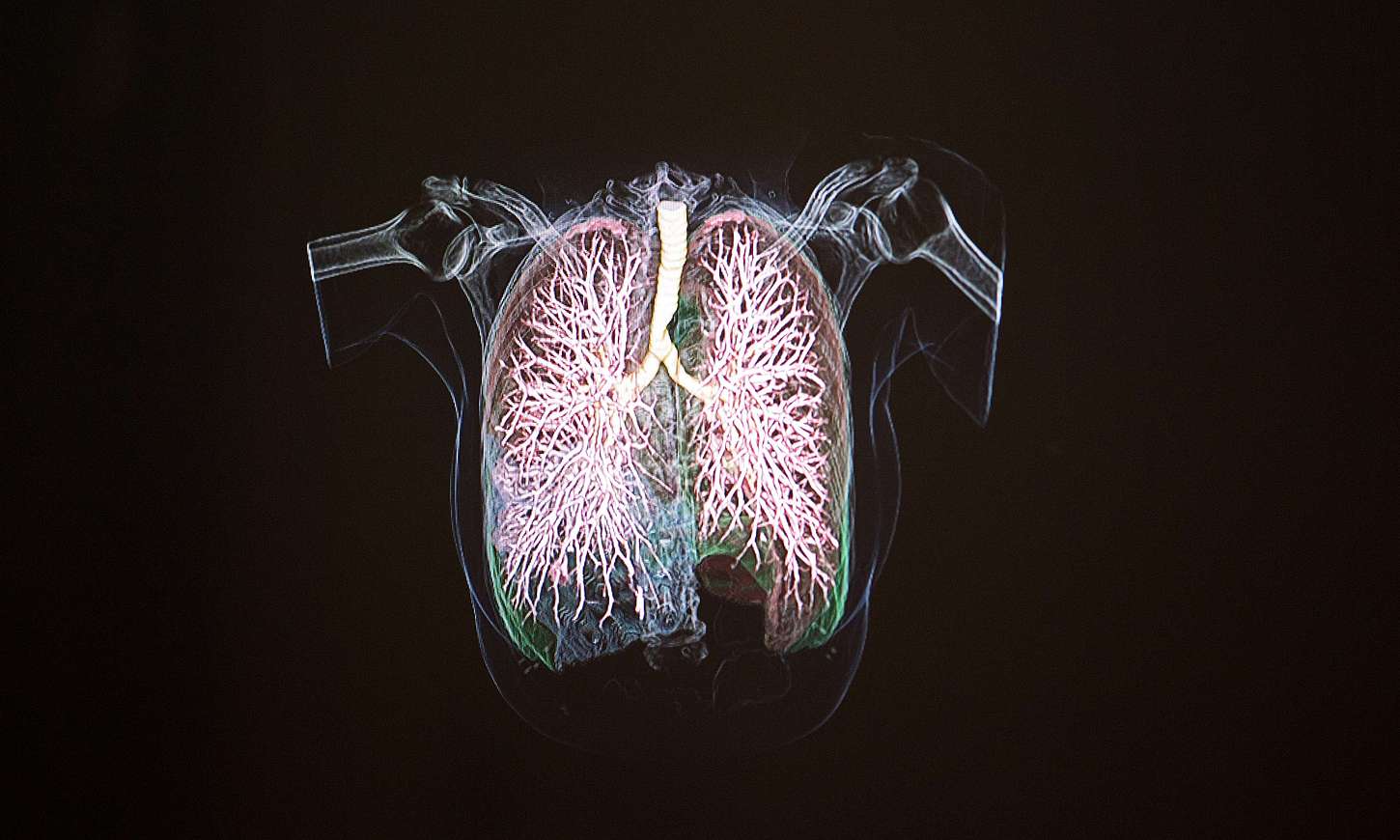 3D visualization of the lung.